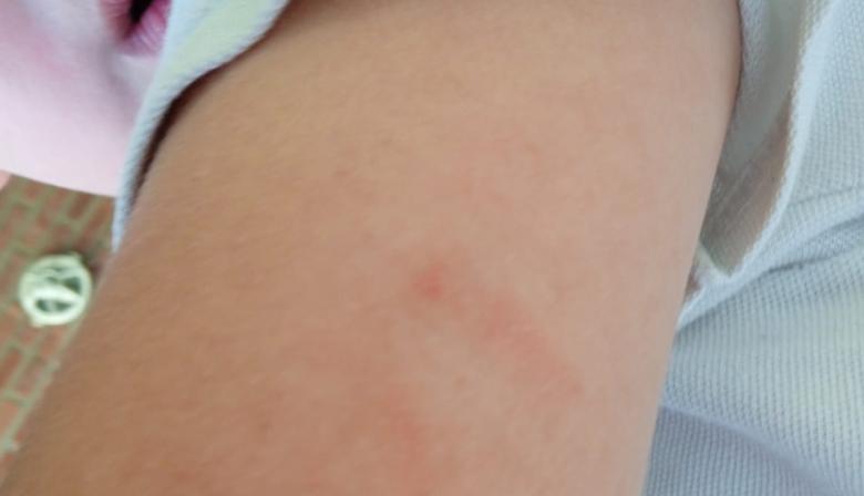 Denuncian que una docente golpeó a un nene de 5 años en un jardín de La Plata