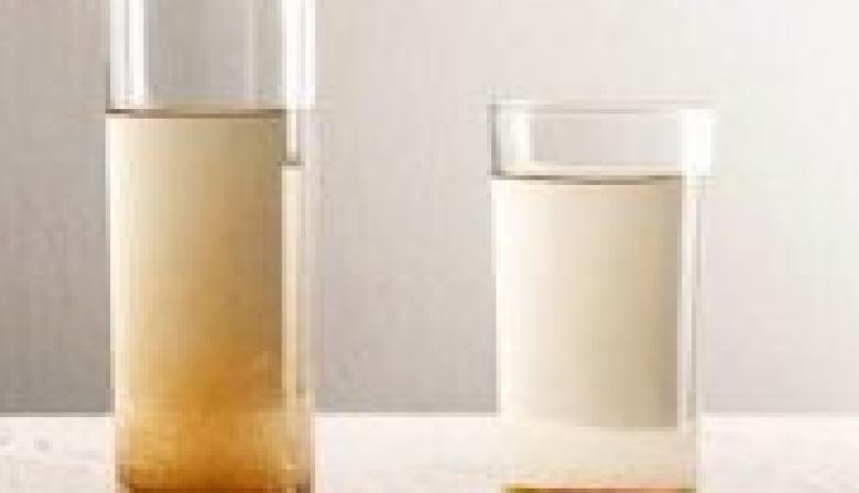 La Plata: denuncian que el agua sale marrón en varios barrios y crece el malestar con ABSA