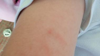 Denuncian que una docente golpeó a un nene de 5 años en un jardín de La Plata