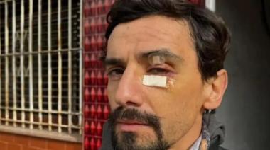 Vio el video de un brutal robo en La Plata, reconoció a su hijo y pidió que lo detengan