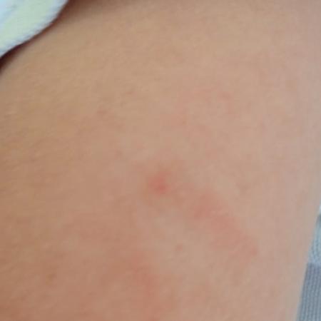 Denuncian que una docente golpeó a un nene de 5 años en un jardín de La Plata